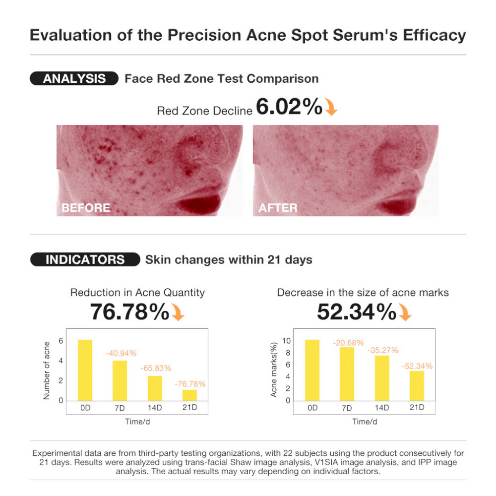 Glimify Salicylic Acid spot treatment serum for blemishes