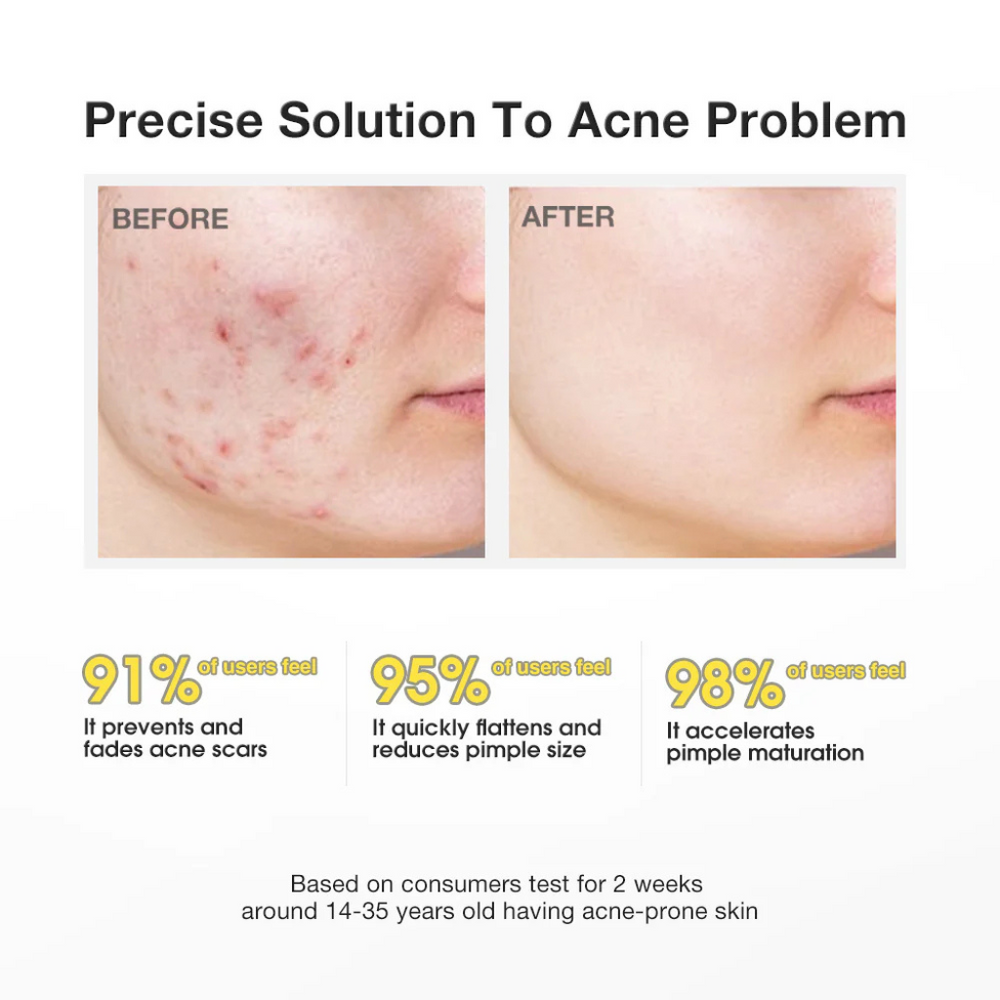 Glimify Salicylic Acid spot treatment serum for blemishes