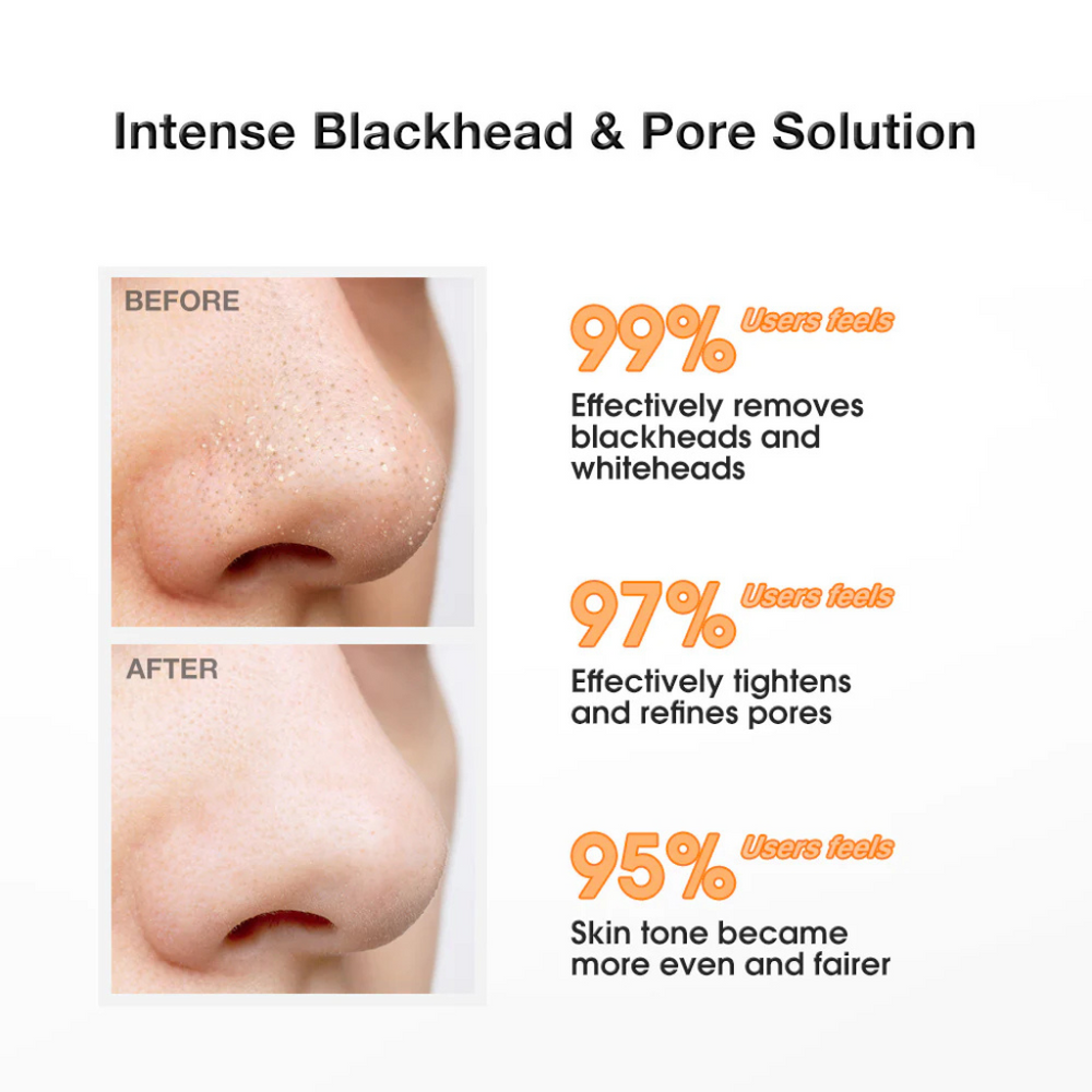 Glimify Salicylic Acid blackhead and pore minimising set